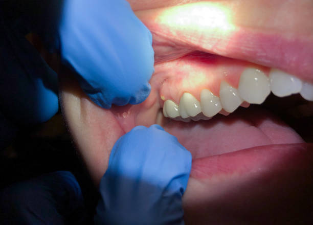 Best Urgent Care for Lost Fillings or Crowns in Bon Aqua Junction, TN