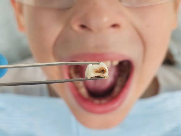 Best Emergency Treatment for Dental Infections or Abscesses in Bon Aqua Junction, TN